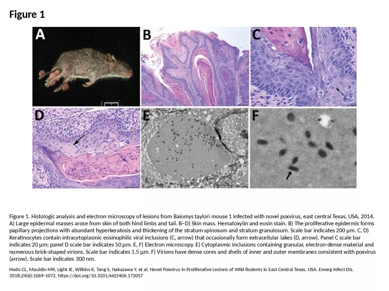 PPT-Figure 1 Figure 1. Histologic analysis and electron microscopy of lesions from Baiomys