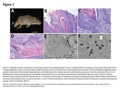 Figure 1 Figure 1. Histologic analysis and electron microscopy of lesions from Baiomys taylori mous