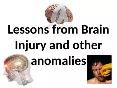 Lessons   from   Brain