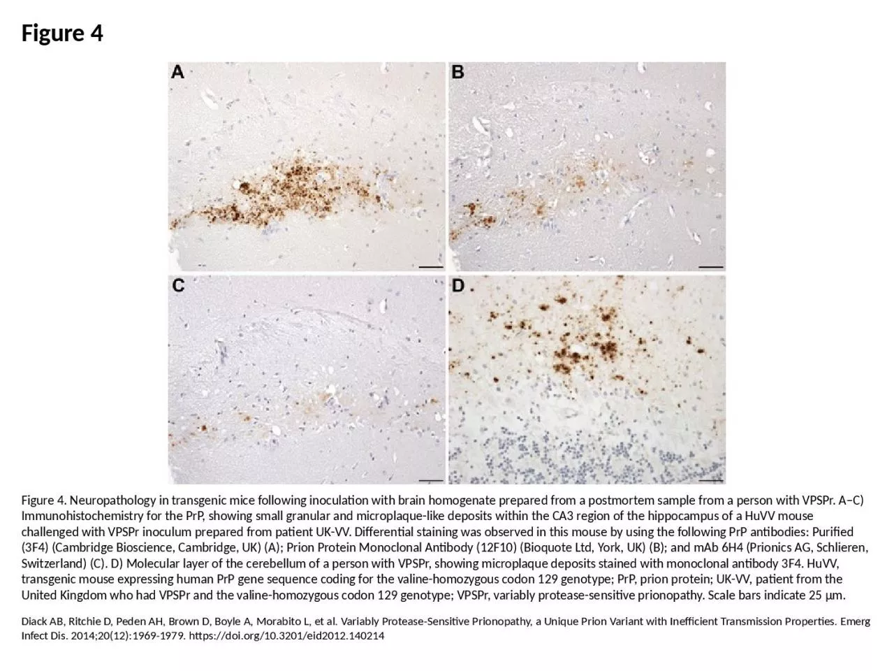 PPT-Figure 4 Figure 4. Neuropathology in transgenic mice following inoculation with brain