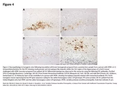 Figure 4 Figure 4. Neuropathology in transgenic mice following inoculation with brain