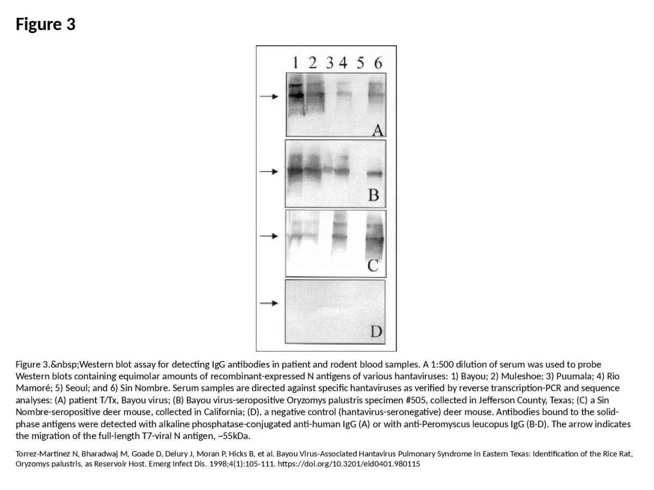 PPT-Figure 3 Figure 3.&nbsp;Western blot assay for detecting IgG antibodies in patient