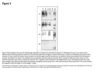 Figure 3 Figure 3.&nbsp;Western blot assay for detecting IgG antibodies in patient