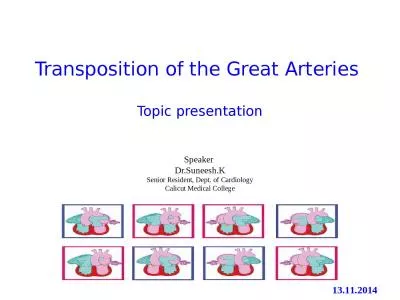 Transposition of the Great Arteries