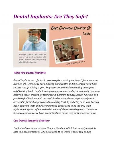 Dental Implants: Are They Safe?