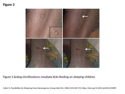 Figure 3 Figure 3.&nbsp;Ornithodoros moubata ticks feeding on sleeping children.