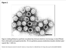 Figure 1 Figure 1.&nbsp;Rotavirus particles visualized by immune electron microscopy in stool f