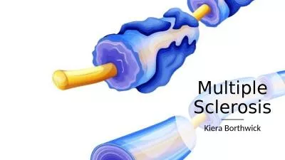 Multiple Sclerosis Kiera Borthwick