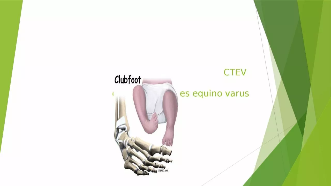 PPT-CTEV congenital talipes equino varus