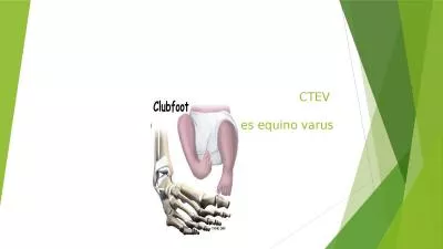 CTEV  congenital talipes equino varus