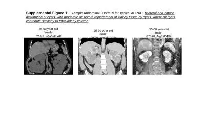 Supplemental Figure 1:  Example Abdominal CTs/MRI for Typical ADPKD: