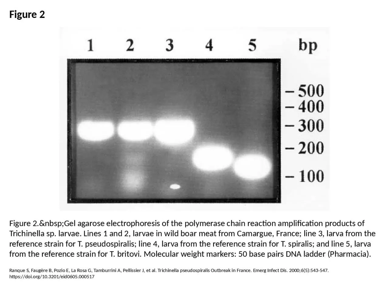 PPT-Figure 2 Figure 2.&nbsp;Gel agarose electrophoresis of the polymerase chain reaction