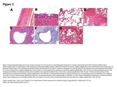 Figure 3 Figure 3.&nbsp;Histopathologic lesions in the trachea and lungs of control