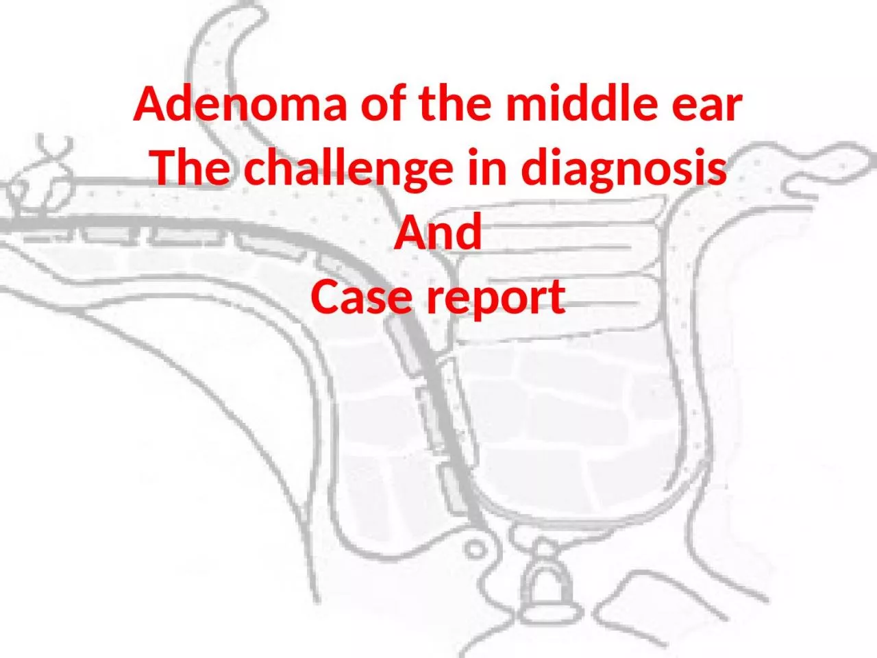 PPT-Adenoma of the middle ear