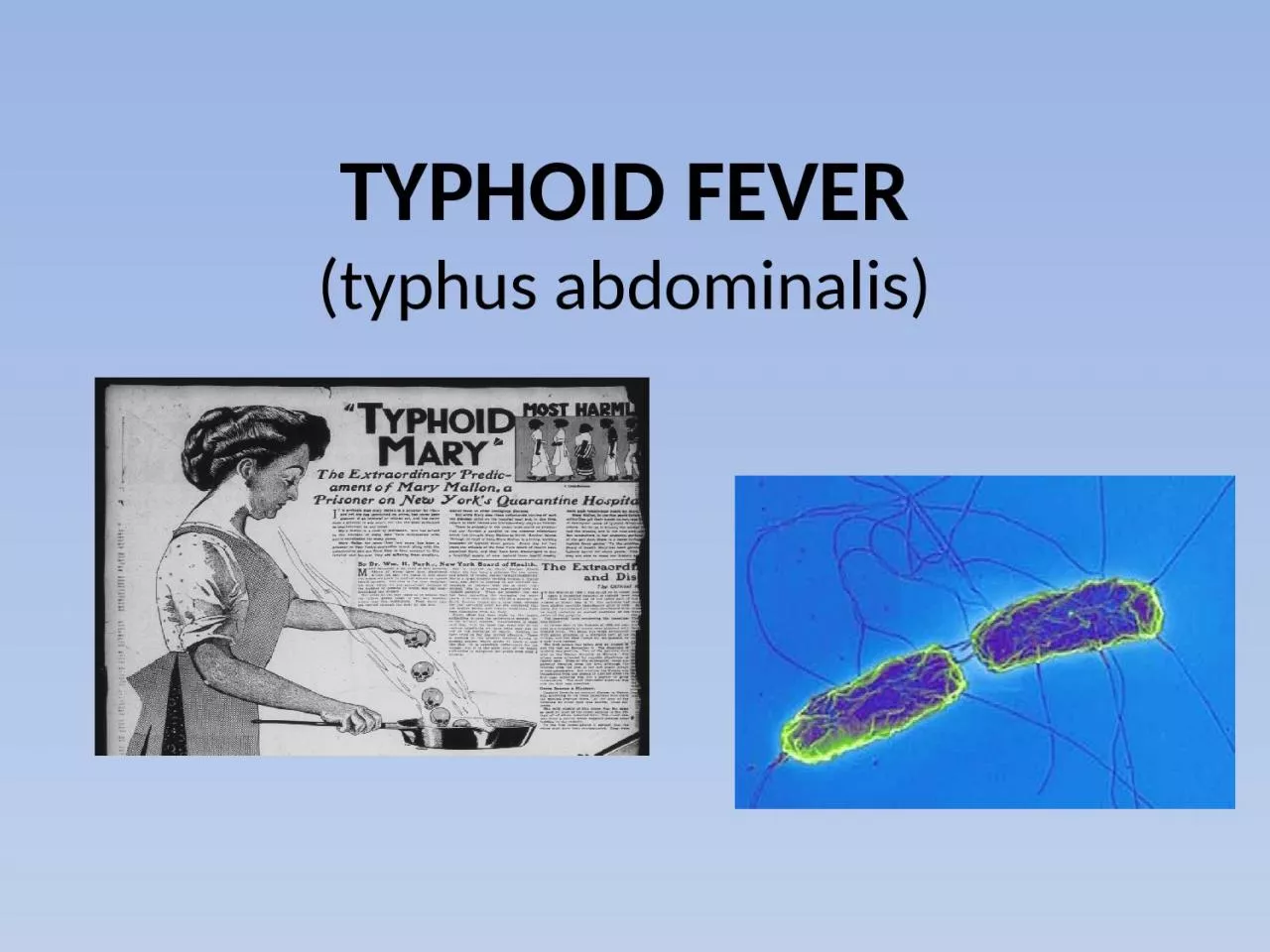 PPT-TYPHOID FEVER (typhus abdominalis