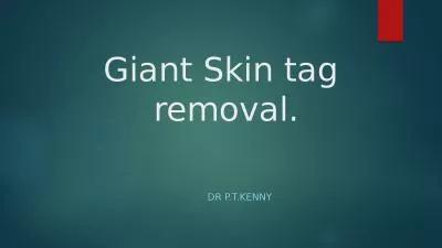 Giant Skin  tag   removal.