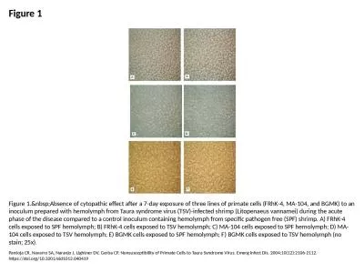 Figure 1 Figure 1.&nbsp;Absence of cytopathic effect after a 7-day exposure of three lines of p