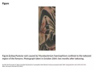 Figure Figure.&nbsp;Pustular rash caused by Mycobacterium haemophilum confined to the tattooed