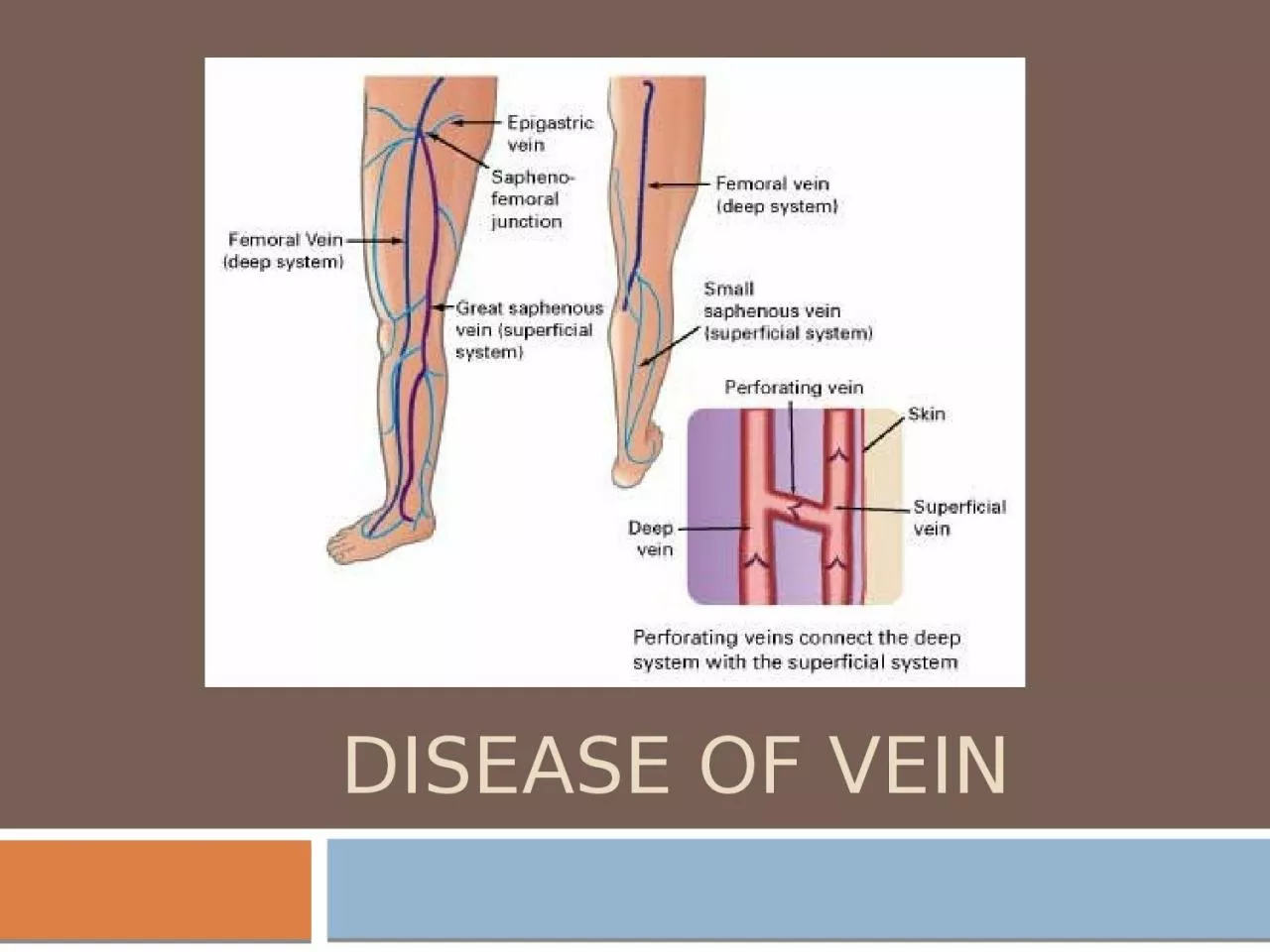 PPT-Disease of vein Key points