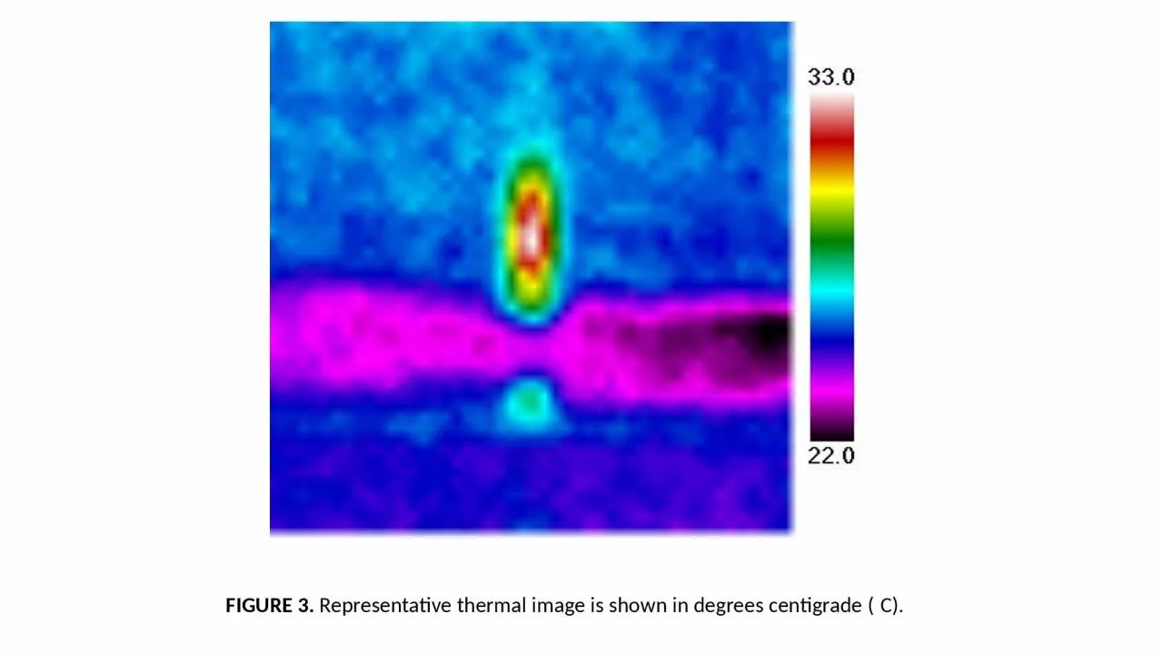 PPT-FIGURE 3. Representative thermal image is shown in degrees centigrade (