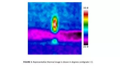 FIGURE 3.  Representative thermal image is shown in degrees centigrade (