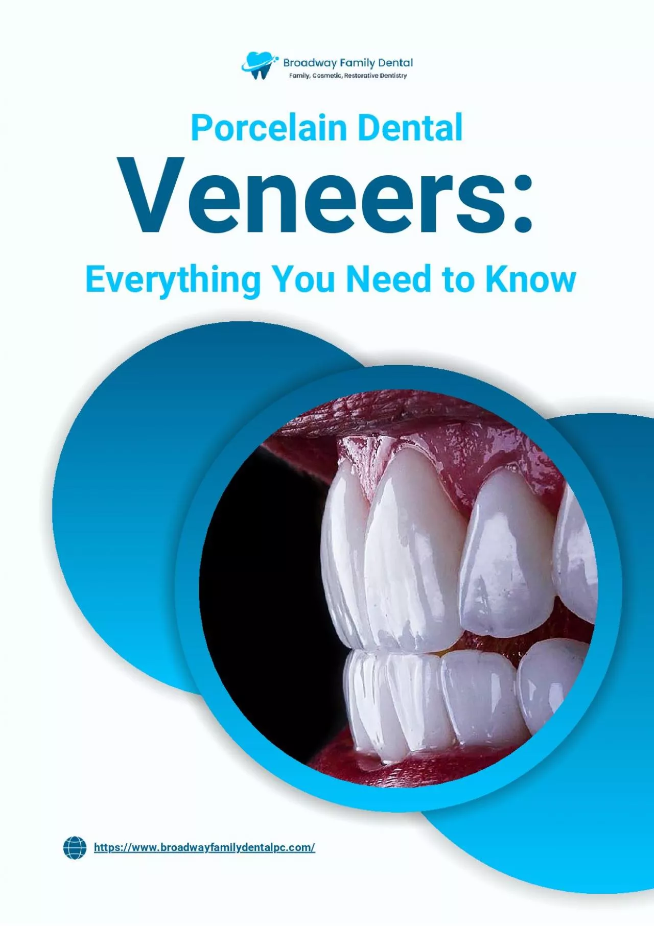 Porcelain Dental Veneers 