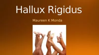 Hallux  Rigidus Maureen K Monda