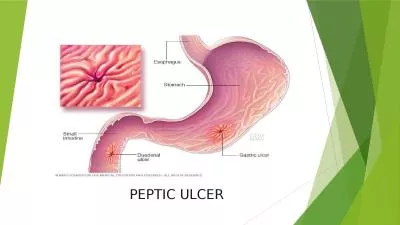 PEPTIC ULCER                PEPTIC ULCER