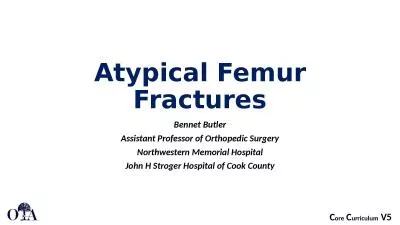 Atypical Femur Fractures