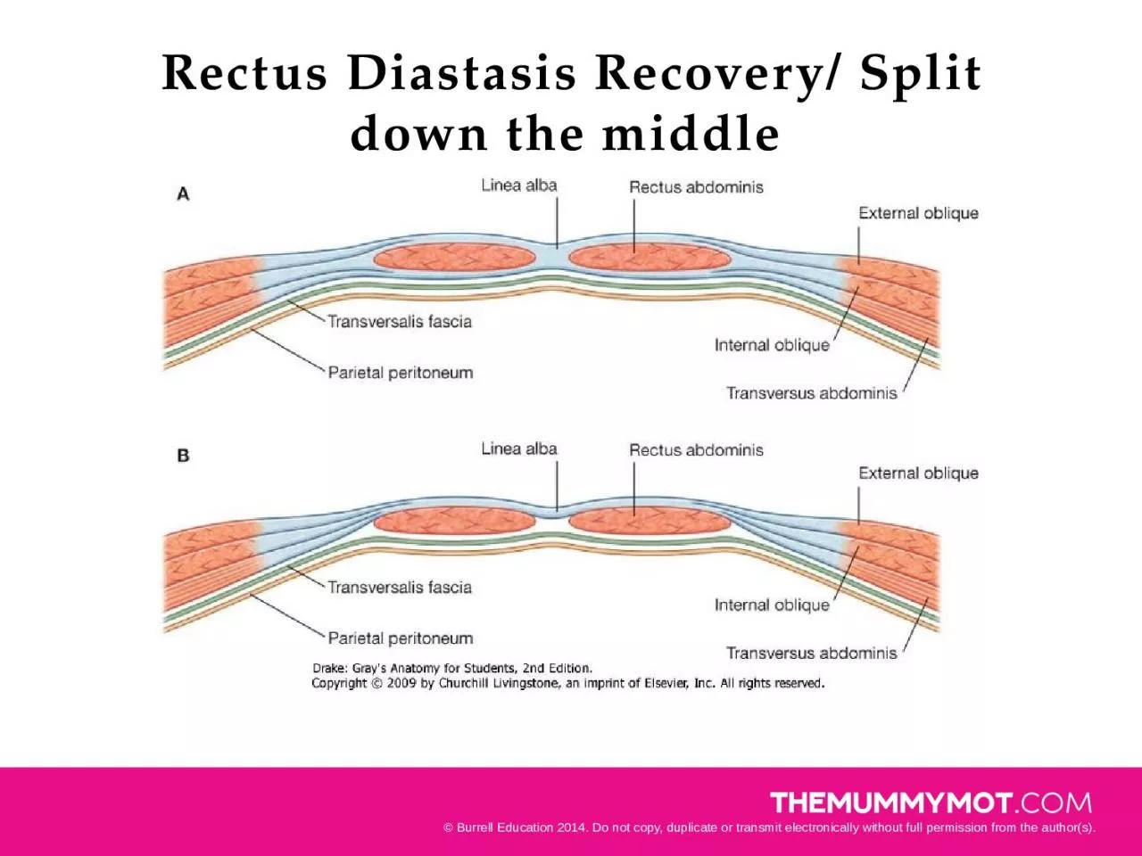Rectus Diastasis Recovery/ Split down the middle