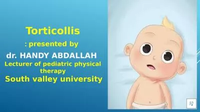 Torticollis   presented by :