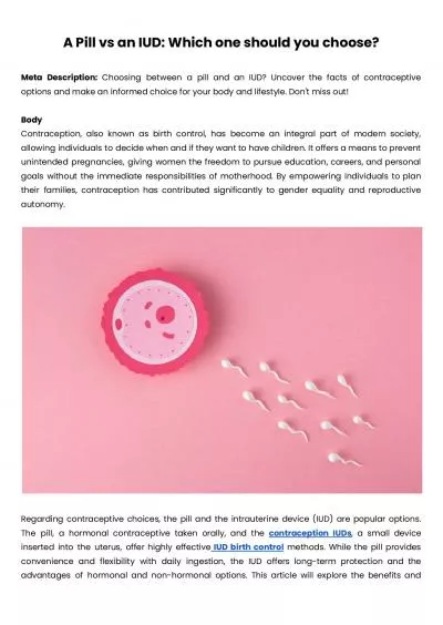 A Pill vs an IUD: Which one should you choose?