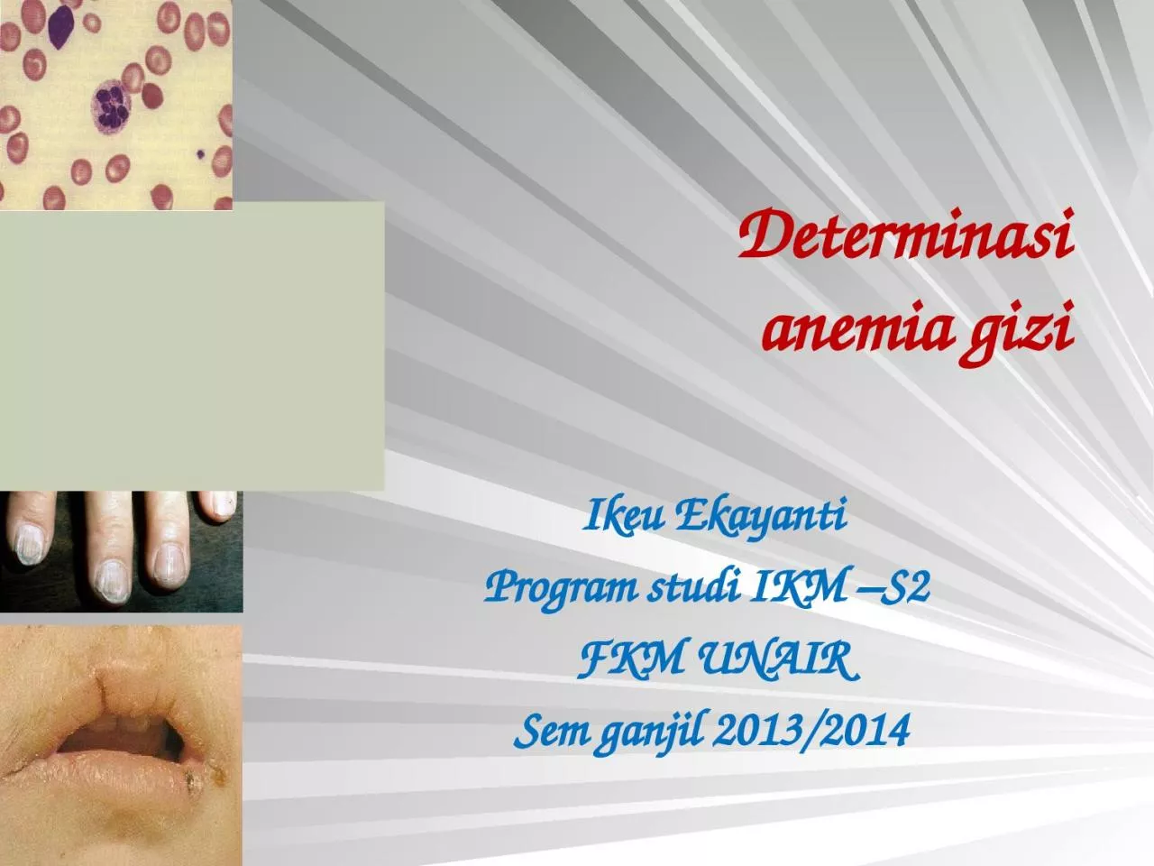 PPT-Determinasi anemia gizi