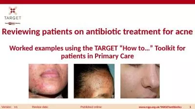 Reviewing patients  on antibiotic treatment for acne