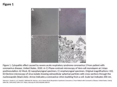 Figure 1 Figure 1. Cytopathic effect caused by severe acute respiratory syndrome coronavirus 2 from