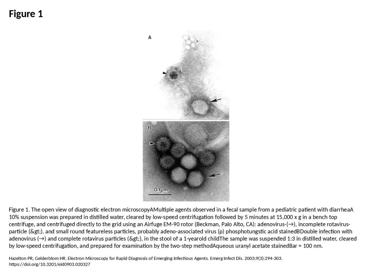 PPT-Figure 1 Figure 1. The open view of diagnostic electron microscopyAMultiple agents observed