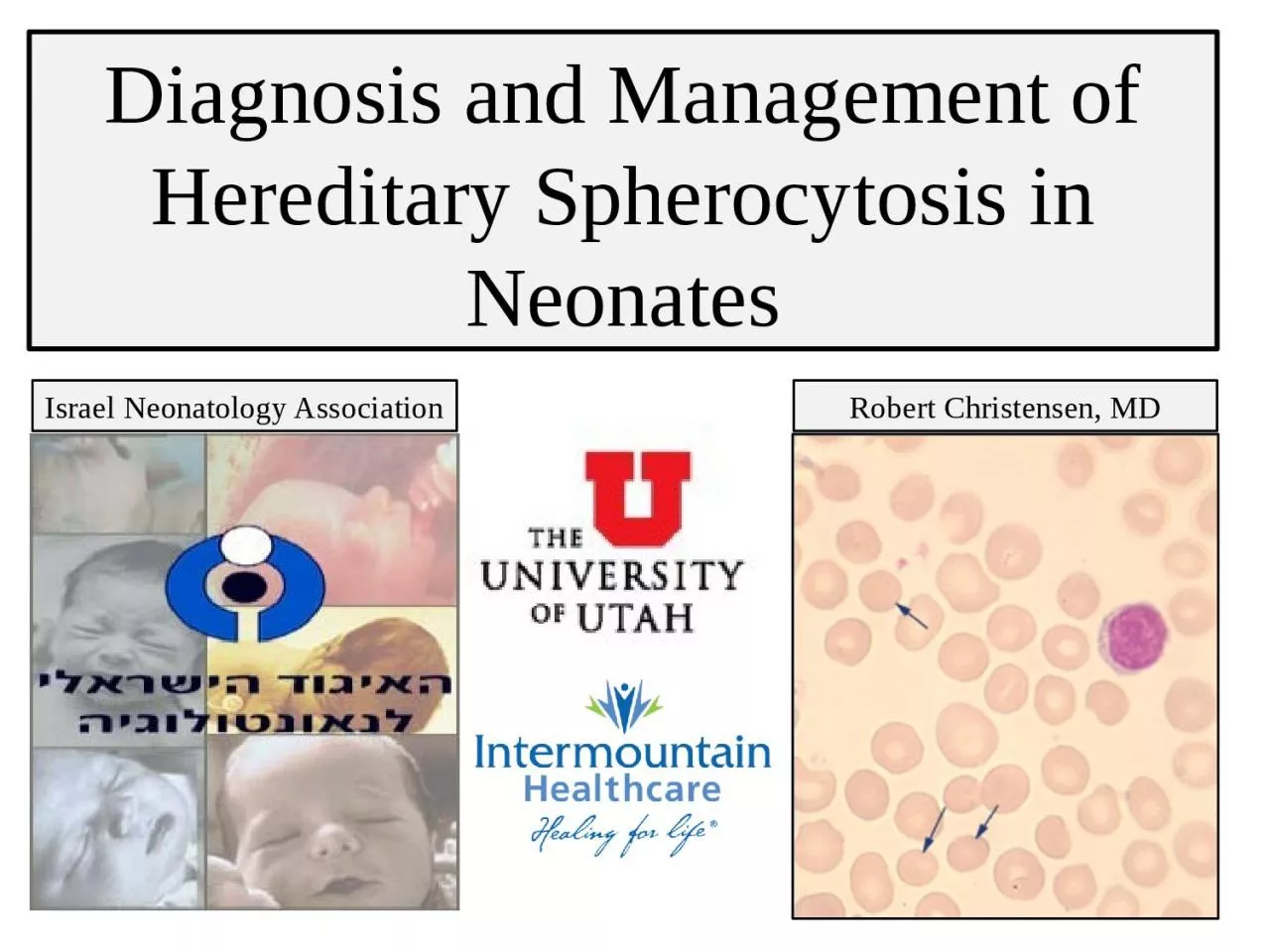 PPT-Diagnosis and Management of Hereditary Spherocytosis in Neonates