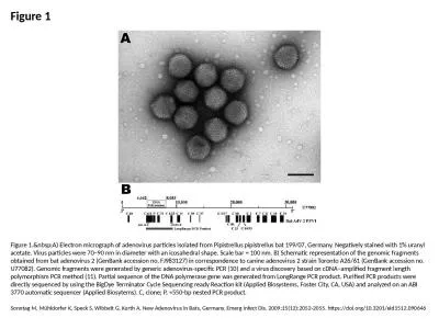 Figure 1 Figure 1.&nbsp;A) Electron micrograph of adenovirus particles isolated from Pipistrell