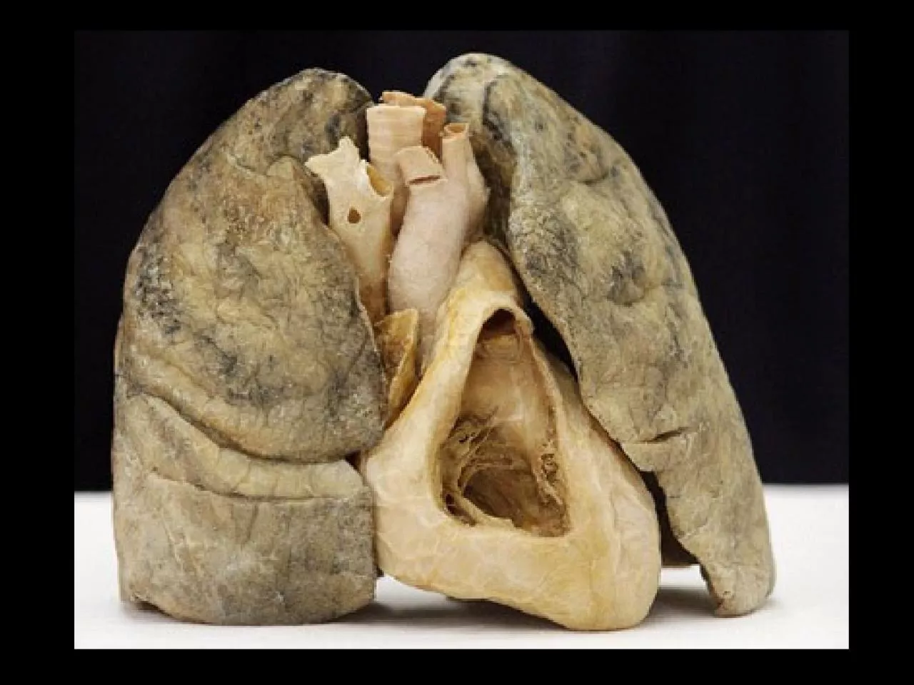 PPT-Ventilation - moves air from the atmosphere to and from alveoli in the lungs.