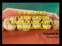 PPT-G.V. BLACK’S CLASSIFICATION