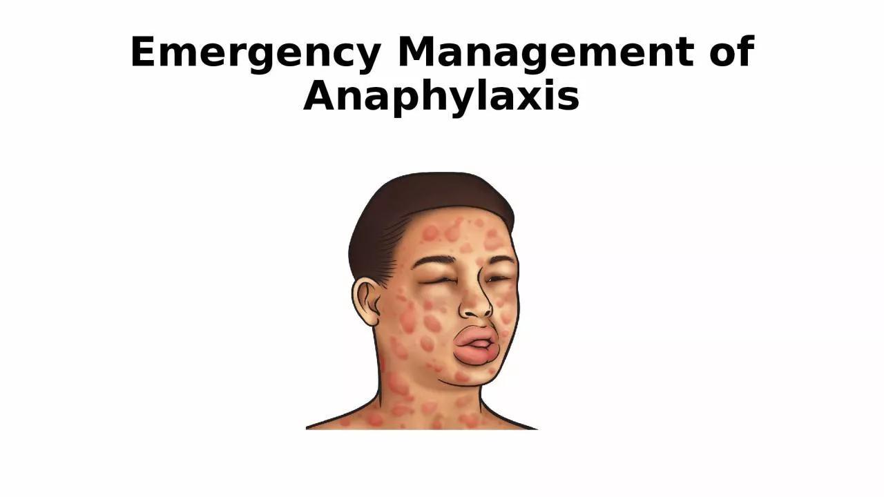 PPT-Emergency Management of Anaphylaxis