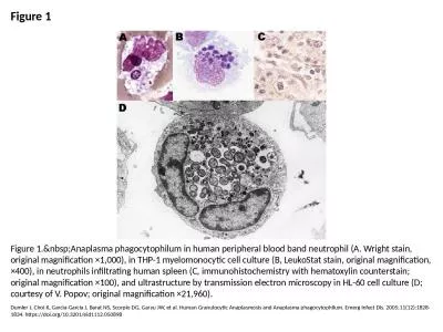 Figure 1 Figure 1.&nbsp;Anaplasma phagocytophilum in human peripheral blood band neutrophil (A.