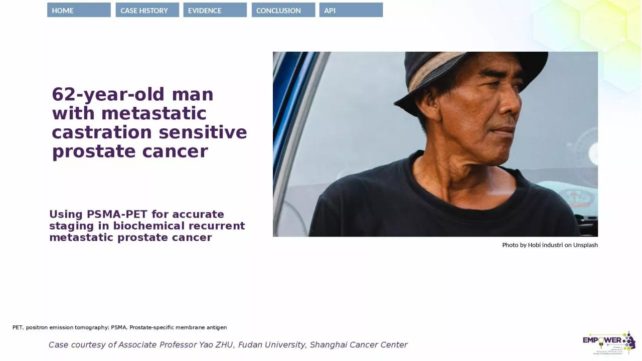 62-year-old man with  metastatic castration sensitive prostate cancer