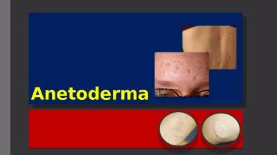 Anetoderma   Definition The term anetoderma