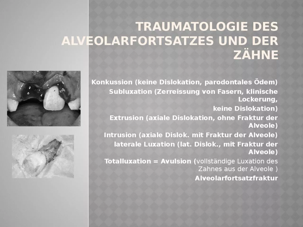 PPT-Traumatologie des Alveolarfortsatzes