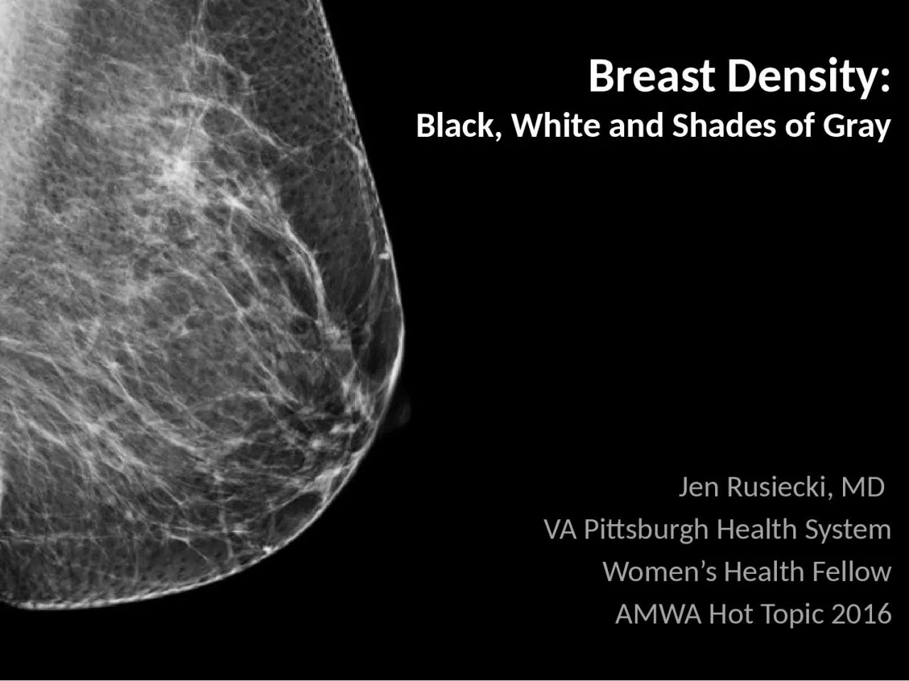 PPT-Breast Density: Black, White and Shades of Gray