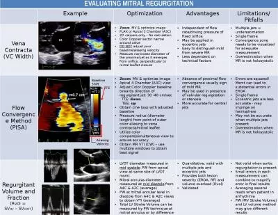 EVALUATING MITRAL REGURGITATION