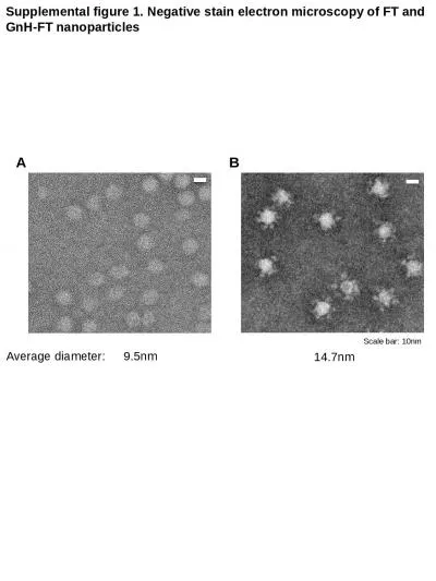 Supplemental figure 1. Negative stain electron microscopy of FT and GnH-FT nanoparticles