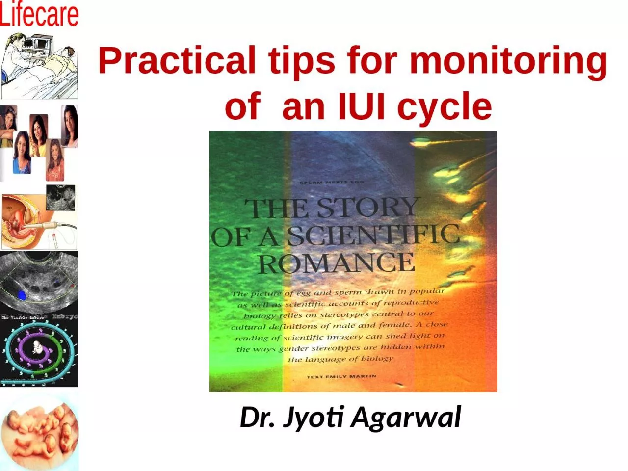 Practical tips for monitoring  of  an IUI cycle
