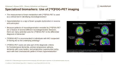 Alzheimer’s disease (AD) – History, definitions and diagnosis